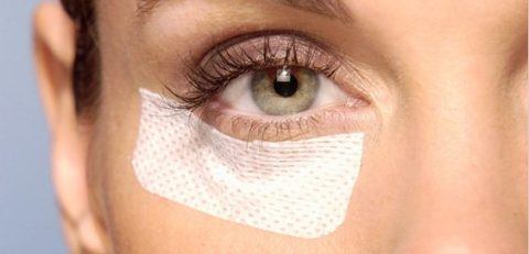 Blepharoplasty: what it is and recovery